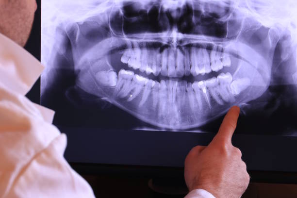 Best Emergency Tooth Extraction in Watertown, SD