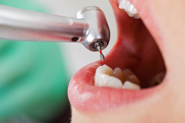 Best Emergency Treatment for Toothache in Watertown, SD